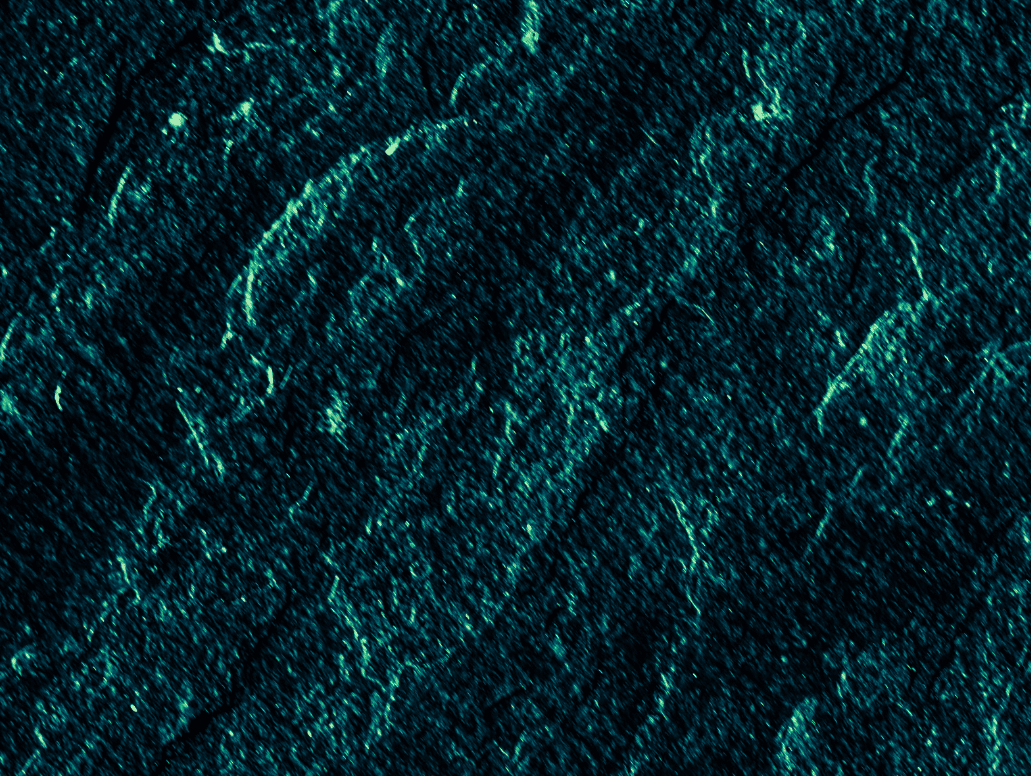 emeraude-vert-texture-zwang-siarnowski-avocat